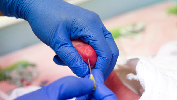 Topuk Kanı Taraması